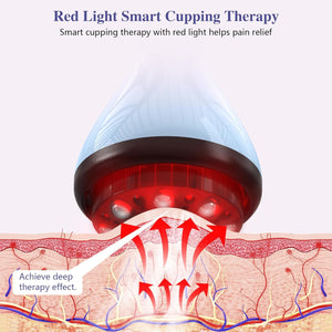 Smart Cupping Therapy Massager